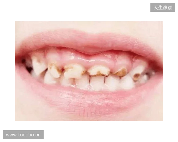 韦林顿确诊上唇部贯通伤;11、21牙半脱位;上颌前牙区牙槽骨骨折